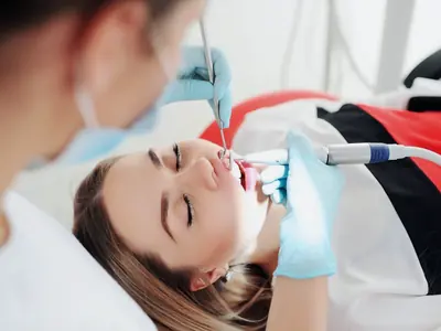 Profilaxie / Estetică dentară: imagine ilustrativă